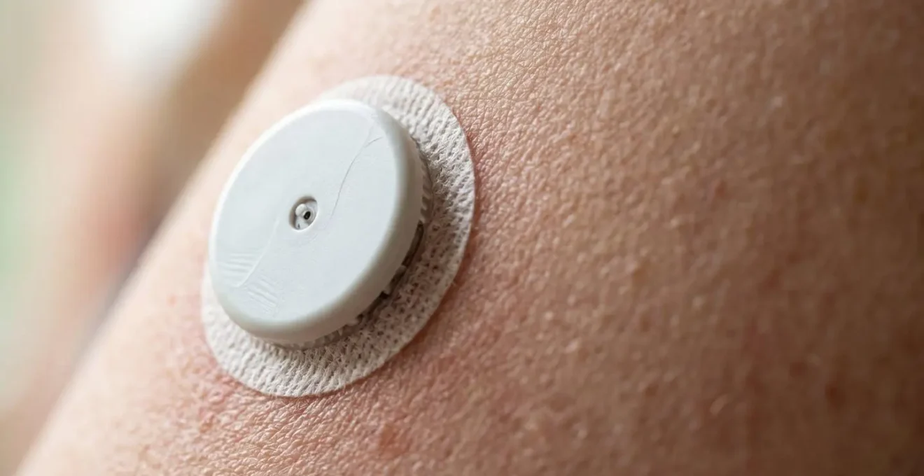 Extreme close-up of continuous glucose monitor sensor on skin